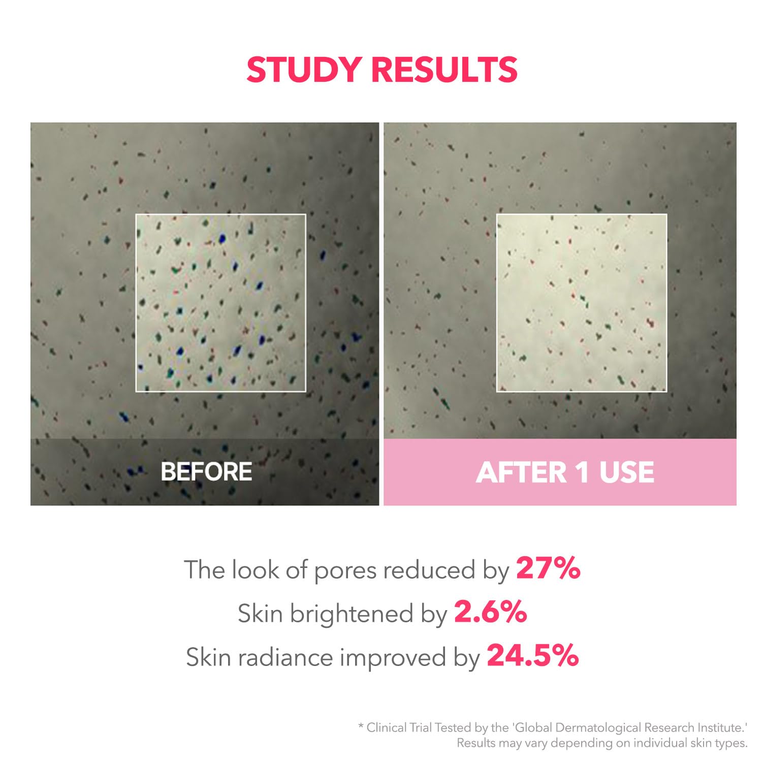 TXA Niacinamide Overnight Wrapping Mask