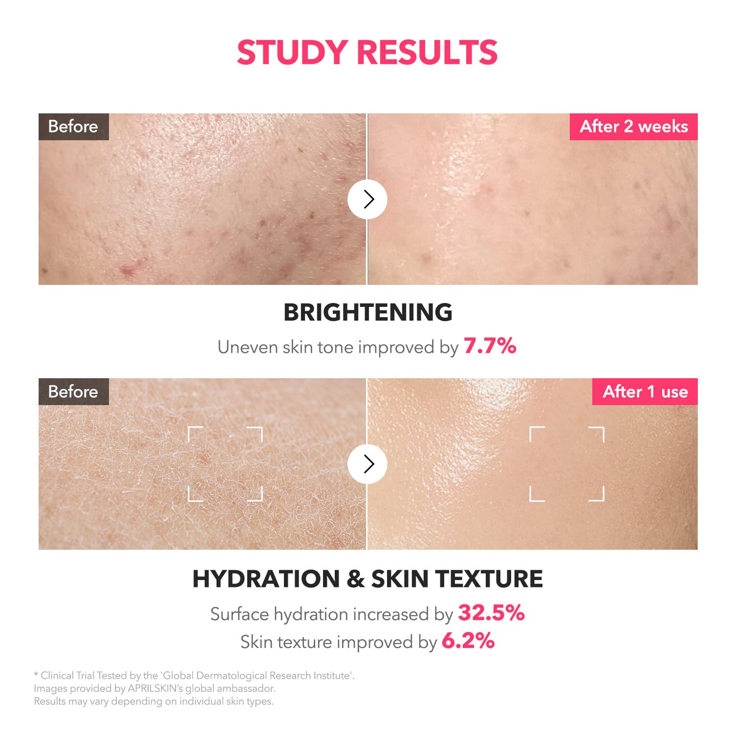 TXA Niacinamide Pink Milky Toner